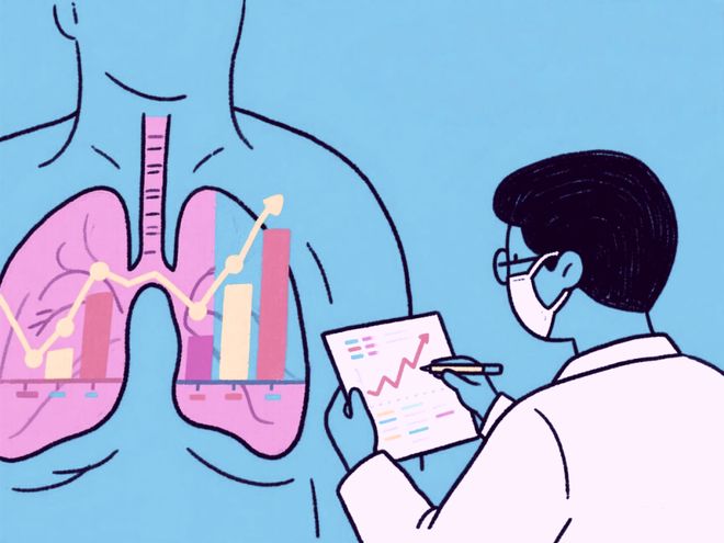 这些高危人群记得筛查肺癌